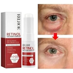 eye-bag-removal-cream-for-women-under-eye-treatment-korean-beauty-instant-firming-solution